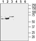 ENT3 (SLC29A3) Antibody in Western Blot (WB)