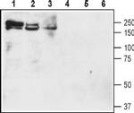 NKCC1 (SLC12A2) (extracellular) Antibody in Western Blot (WB)