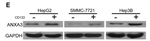 ANXA3 Antibody in Western Blot (WB)