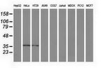 ANXA3 Antibody in Western Blot (WB)