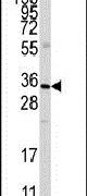 Annexin A3 Antibody in Western Blot (WB)