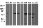 AP2M1 Antibody in Western Blot (WB)