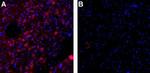 KCNN3 (KCa2.3, SK3) Antibody in Immunohistochemistry (Frozen) (IHC (F))