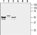 KCNF1 (KV5.1) Antibody in Western Blot (WB)