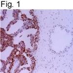 APE1 Antibody in Immunohistochemistry (IHC)