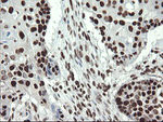 APEX1 Antibody in Immunohistochemistry (Paraffin) (IHC (P))