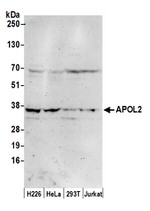 APOL2 Antibody in Western Blot (WB)