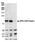 APPL1/DIP13alpha Antibody in Western Blot (WB)