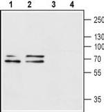 P2X1 Receptor (extracellular) Antibody in Western Blot (WB)