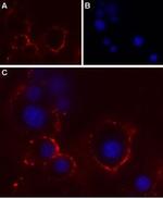P2X4 Receptor (extracellular) Antibody in Immunocytochemistry (ICC/IF)