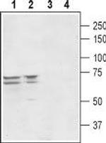 PEX5L (TRIP8b) Antibody in Western Blot (WB)