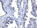 AR Antibody in Immunohistochemistry (Paraffin) (IHC (P))