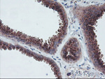 ARCN1 Antibody in Immunohistochemistry (Paraffin) (IHC (P))