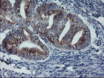 ARCN1 Antibody in Immunohistochemistry (Paraffin) (IHC (P))