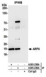 ARF6/ADP Ribosylation Factor 6 Antibody in Western Blot (WB)