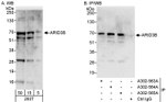 ARID3B Antibody in Western Blot (WB)