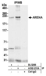ARID4A Antibody in Western Blot (WB)