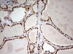 ARL3 Antibody in Immunohistochemistry (Paraffin) (IHC (P))