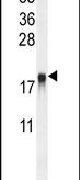 ARL8A Antibody in Western Blot (WB)