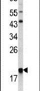 p21 ARC Antibody in Western Blot (WB)