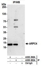 ARPC4 Antibody in Immunoprecipitation (IP)