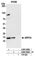 ARPC4 Antibody in Western Blot (WB)