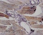 Ryanodine Receptor 1 Antibody in Immunohistochemistry (Paraffin) (IHC (P))