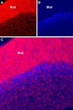 SCN1A (NaV1.1) Antibody in Immunohistochemistry (IHC)