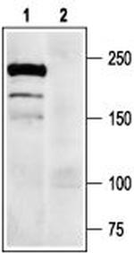NaV1.7 (SCN9A) Antibody in Western Blot (WB)