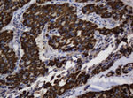 ASGR2 Antibody in Immunohistochemistry (Paraffin) (IHC (P))