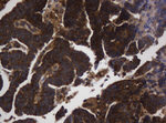 ASGR2 Antibody in Immunohistochemistry (Paraffin) (IHC (P))