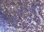 ASGR2 Antibody in Immunohistochemistry (Paraffin) (IHC (P))