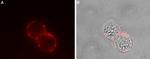 Somatostatin Receptor Type 2 (extracellular) Antibody in Immunocytochemistry (ICC/IF)