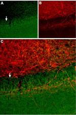 Somatostatin Receptor Type 2 (extracellular) Antibody in Immunohistochemistry (Frozen) (IHC (F))