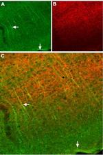 Somatostatin Receptor Type 2 (extracellular) Antibody in Immunohistochemistry (Frozen) (IHC (F))