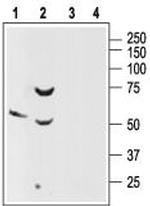 Somatostatin Receptor Type 2 (extracellular) Antibody in Western Blot (WB)