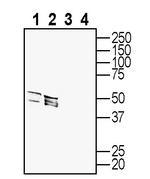5HT2A Receptor (HTR2A) (extracellular) Antibody in Western Blot (WB)