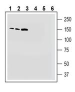 TMC1 (extracellular) Antibody in Western Blot (WB)