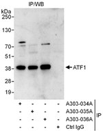 ATF1 Antibody in Immunoprecipitation (IP)