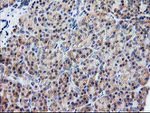 ATG3 Antibody in Immunohistochemistry (Paraffin) (IHC (P))