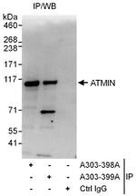 ATMIN Antibody in Immunoprecipitation (IP)