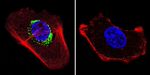 ATP Synthase beta Antibody in Immunocytochemistry (ICC/IF)