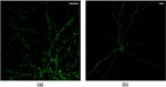 ATP1A3 Antibody in Immunocytochemistry, Immunohistochemistry (ICC/IF, IHC)