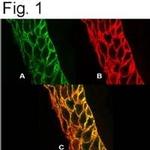 PMCA4 ATPase Antibody in Immunocytochemistry (ICC/IF)