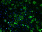 ATP5B Antibody in Immunocytochemistry (ICC/IF)