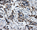 ATP5B Antibody in Immunohistochemistry (Paraffin) (IHC (P))