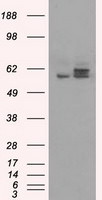 ATP5B Antibody in Western Blot (WB)