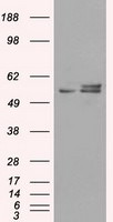 ATP5B Antibody in Western Blot (WB)