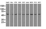 ATP5B Antibody in Western Blot (WB)