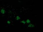 ATP6V1B1 Antibody in Immunocytochemistry (ICC/IF)